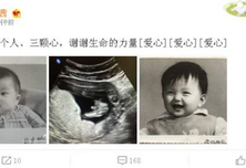 孙茜怀孕三个月B超照片首亮相