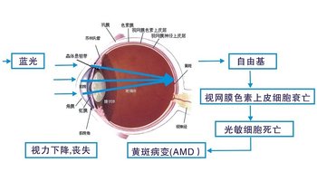 蓝光对眼睛的伤害机制