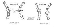 颈椎不稳