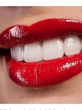 【上海周启山口腔诊所】高品质洗牙套餐!仅98