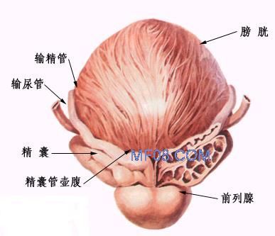 精囊肿瘤