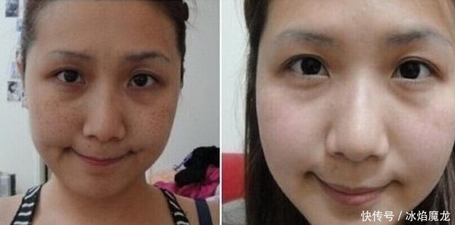 有了“老年斑”不要紧张,教你1个土方子,3次斑连根拔除! bbin平台官网