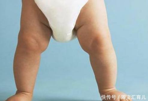 宝宝出现O型腿,是长期使用纸尿裤导致的吗?