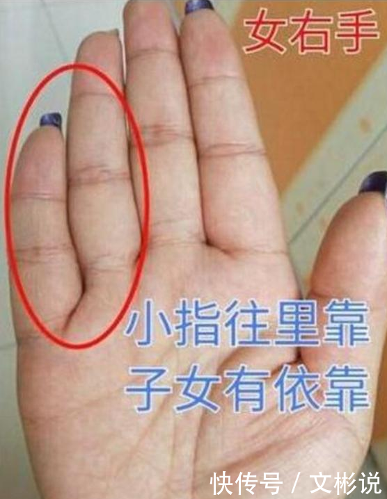 小拇指有“此”特征的人,必是富贵双全