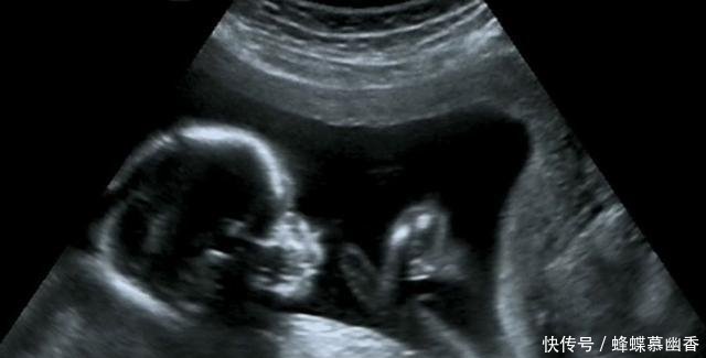 胎儿发育大小和怀孕周数不符, 偏大或偏小, 这是