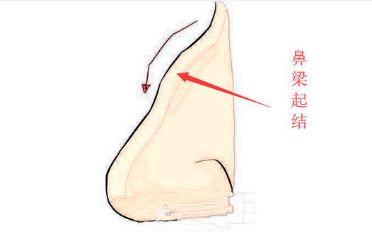 这4种面相的人最小气，为人刻薄，脾气暴躁，很容易背叛朋友！