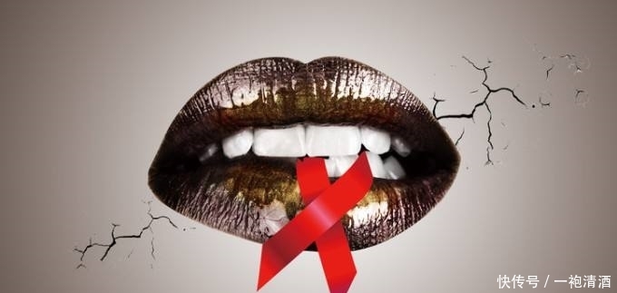 艾滋病潜伏期时,嘴巴可能会落下3个记号,早