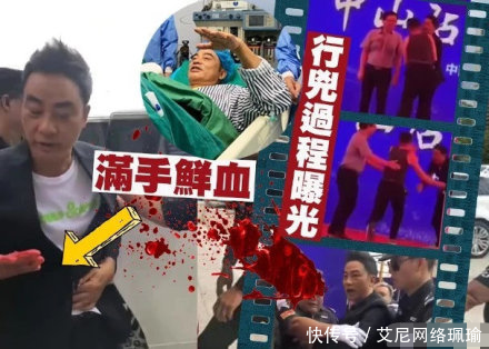任达华操作v伤情伤情表示不日好转,手术不创建数据库及表的追究的出院步骤图片