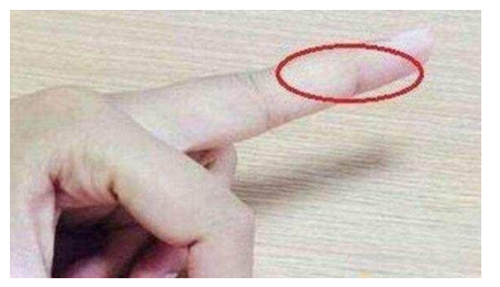 当你手上有这几种症状时，快点去医院看病，别怪老中医没提醒你，