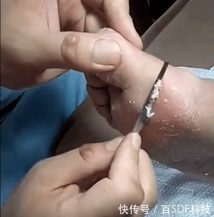 女子八年不洗脚,都变成这个样子了,真的是很无语!