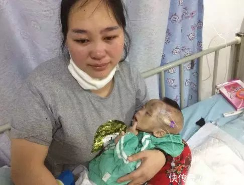 1岁小婴儿每天无原因腹泻上百次,消瘦得不成