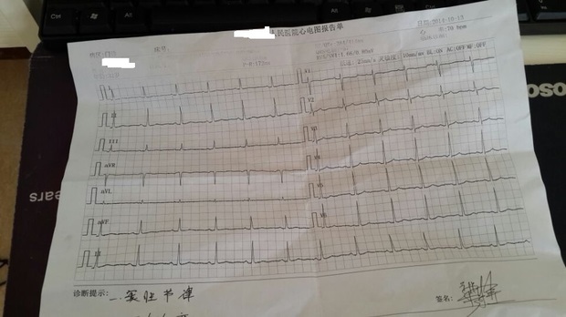 心电图 窦性心律 T波改变是什么意思_365问答