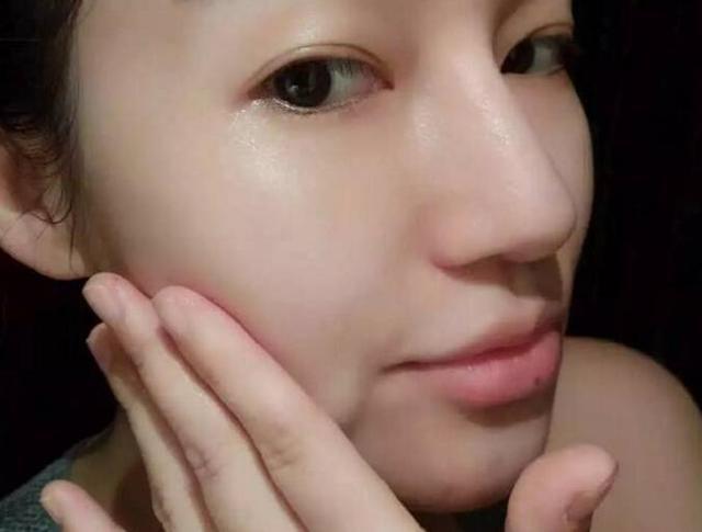 几块钱的阿司匹林:祛斑效果这么好 - 朋友 - 朋 友 几块钱的阿司匹林:祛斑效果这么好 - 一统江山 - 一统江山的博客
