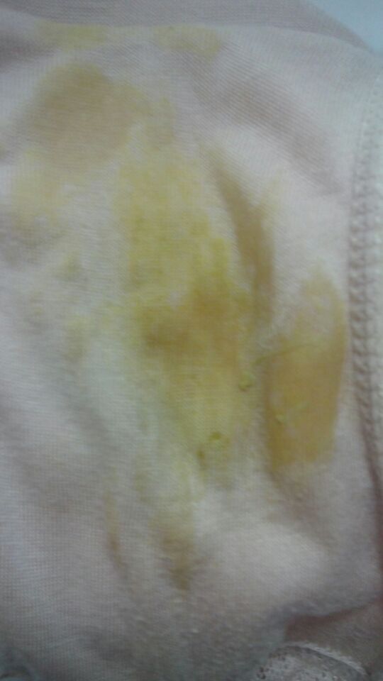 药啊希米用了2个多疗程了 这几天有流出<em>黄黄</em>的