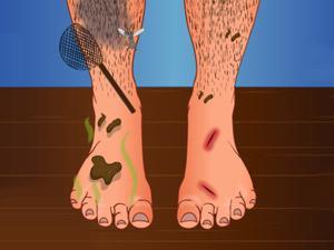 臭脚手术,臭脚手术小游戏,360小游戏-360游戏