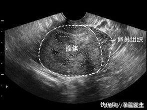 女学生的肚子越来越大,同学嘲笑质疑,谁也没想