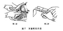 骶耻外径