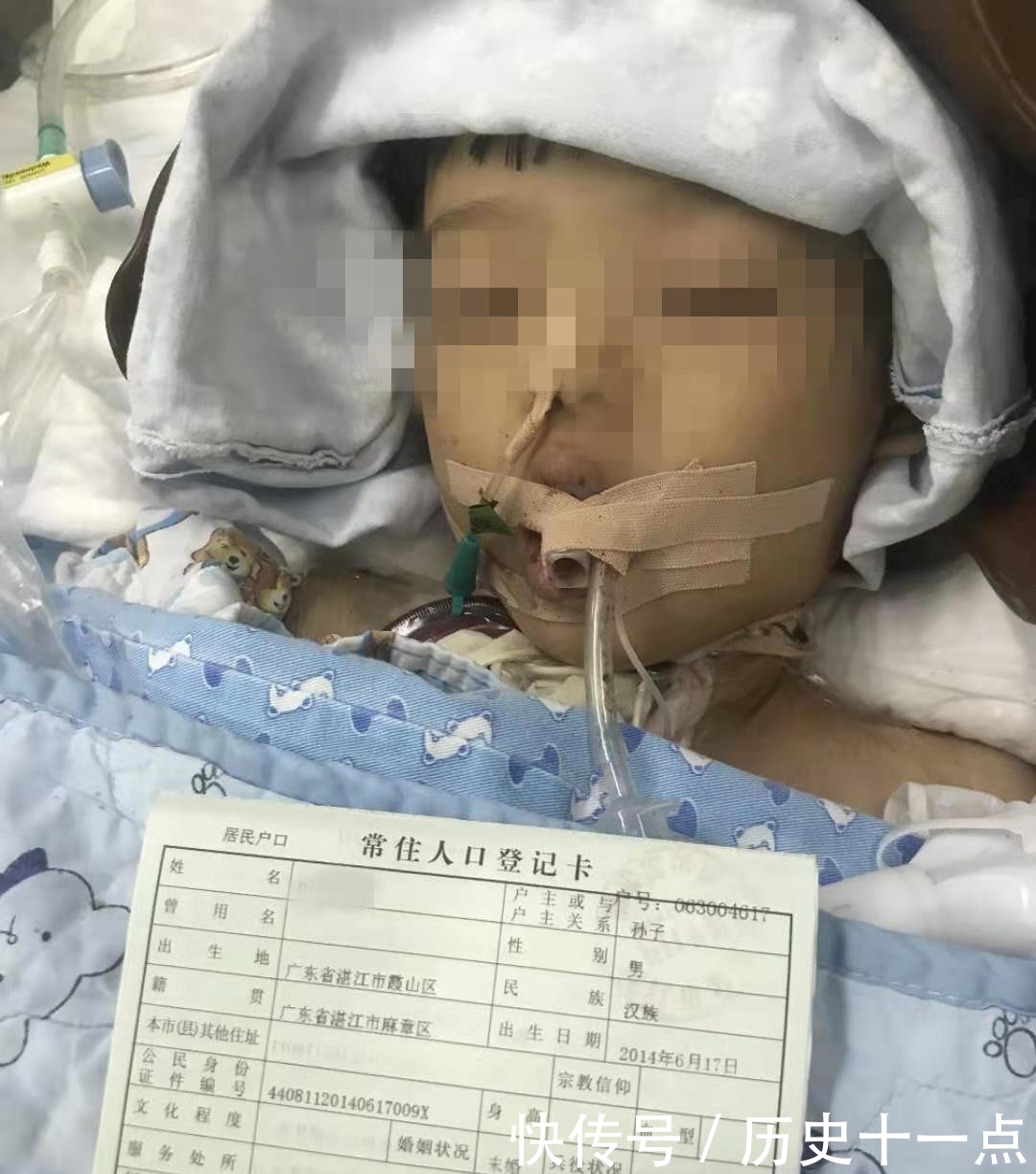 幼儿园食物中毒