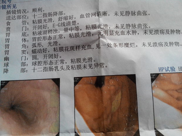 慢性浅表性胃炎伴糜烂,要吃多久的药?