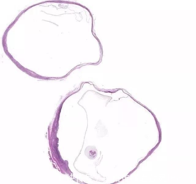 头皮发麻!女子手臂鼓起一个包、有动感,切开一
