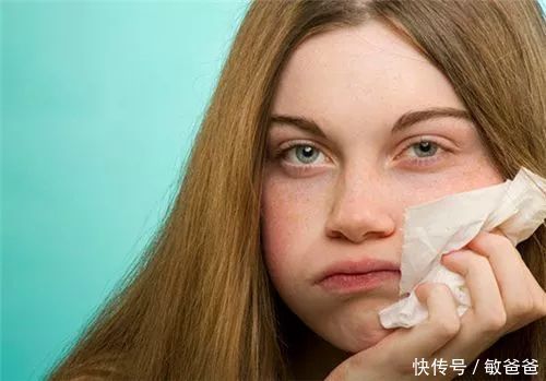 诊疗师敏爸爸:中国医药报 | 皮肤过敏 门面问题