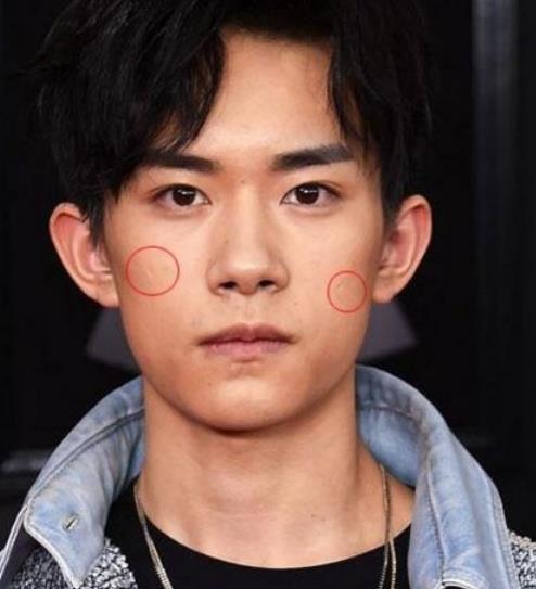 明星脸上的疤怎么来的?胡歌车祸,千玺打架,杨