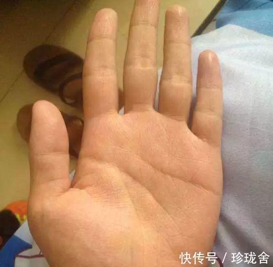 你的小指代表子女和大半生福运!