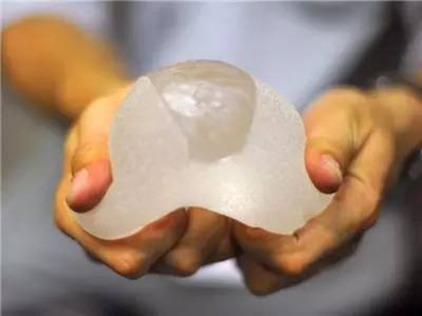 女子乳房手术失败 隆胸后植入的自体脂肪被按摩破裂