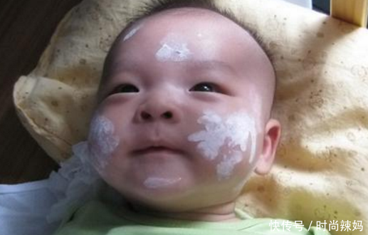 以下5种疾病只遗传男不传女,婴儿一旦患上此病,将一生难以治愈