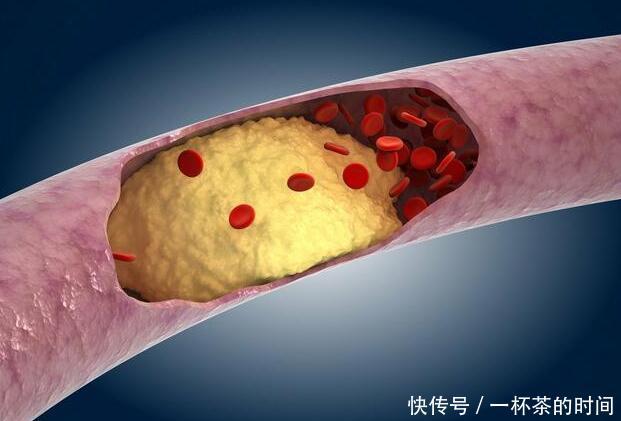 心血管疾病，原来毛病出在这两处，1招让你血液年轻20岁!