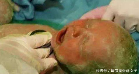 孕妇怀胎8月浑身发痒, 医生检查后急剖腹, 看到孩子婆婆崩溃大哭