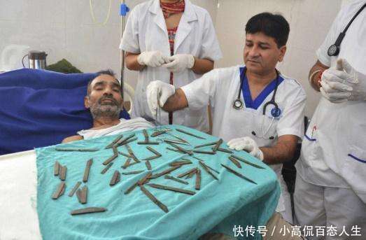 男子肚子疼疑似急性阑尾炎, 去医院检查后, 竟取