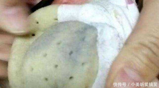 疙瘩,听从医生的话拆开内衣,对着男友就是两巴掌