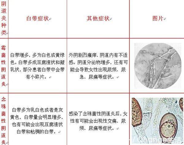 3种妇科病会传染给男性,要当心了!