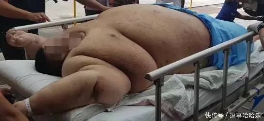 420斤胖子离世,火葬场员工说的话让家属气的直咬牙