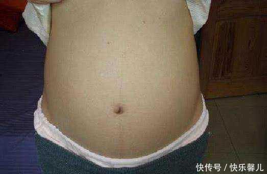 怀孕3个月孕妇腹痛出血,就医诊断胎儿不保,原
