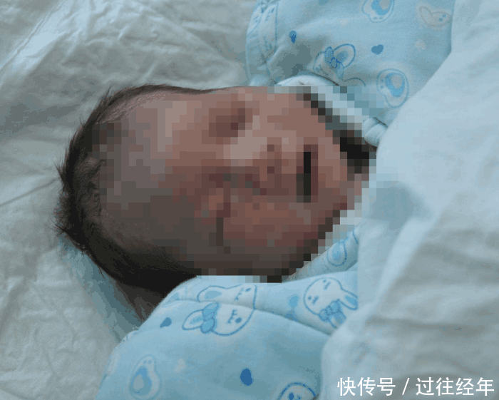 孩子长出这玩意哭闹不停, 宝妈看见后直接拔掉, 结果孩子不幸夭折