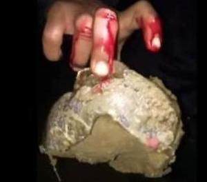 小伙等鱼等得无聊,看到淤泥里埋着一块石头,刚一碰就鲜血直流