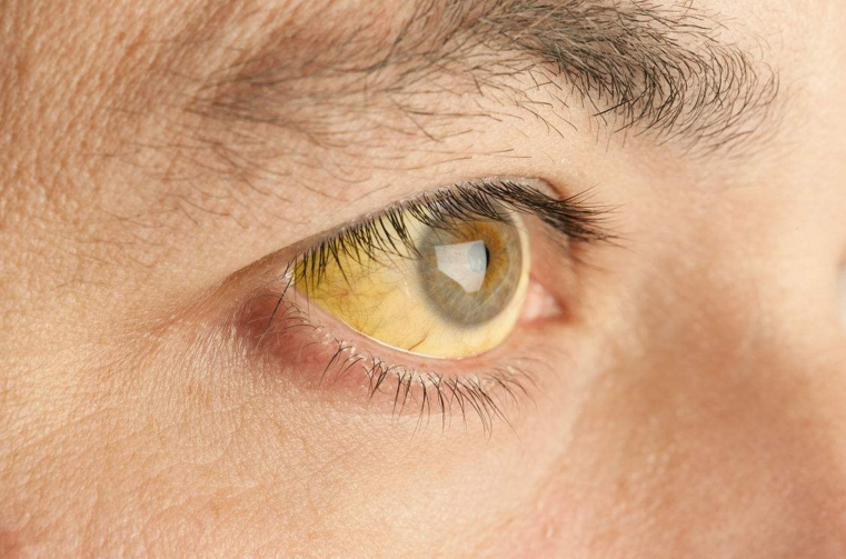 肝脏有癌细胞,身体2个地方变化大,做4件事一脚