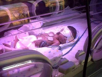 40岁患病母亲生下1斤多点女婴，当时没有玩具大如今6岁很健康_图1