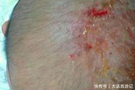 4个月宝宝高烧不退,紧急检查后,医生怒斥宝妈