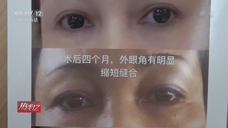 热线12 《热线12》 20220421