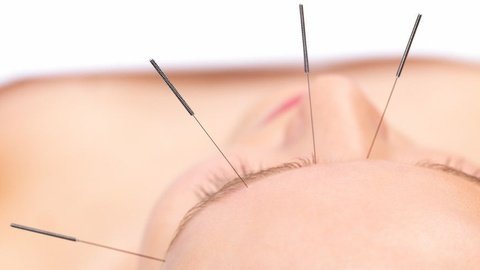 健康诊聊室 睑板腺功能障碍与针灸有何关系