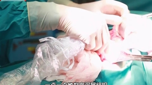 好人故事 “B超神探”贾立群