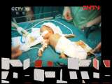 健康之路 《健康之路》 20110903 早产的宝宝