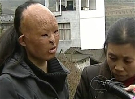 好女人 爱心呼叫之鬼面女孩爱美丽