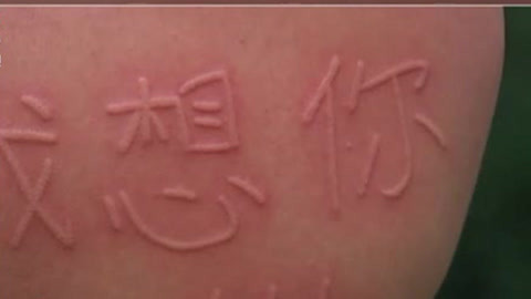 经典传奇 解密皮肤能写字的奇人 这是绝技还是怪病？