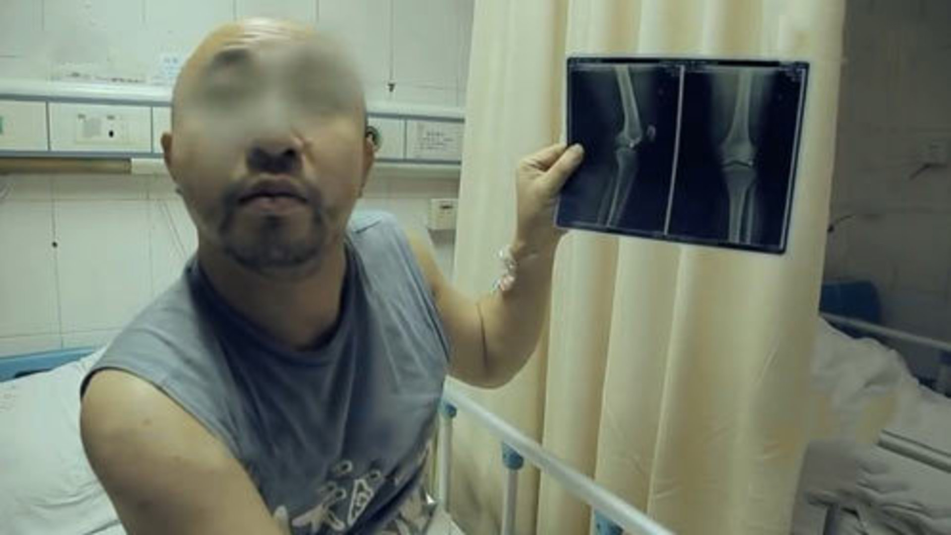 百姓故事汇 男子深夜在家莫名中枪