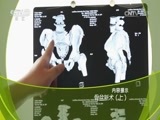 走近科学 《走近科学》 20170425 骨盆新术（上）