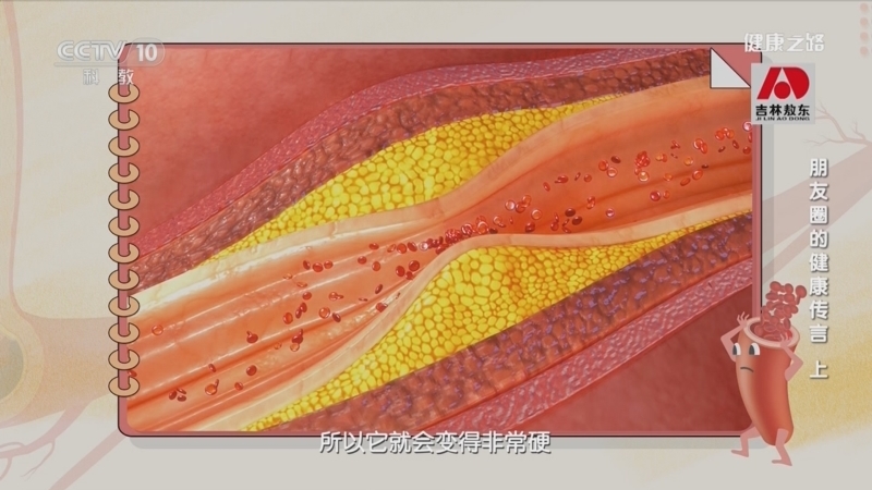 健康之路 《健康之路》 20230301 朋友圈的健康传言（上）